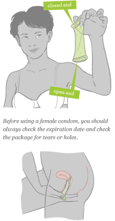 female-condom@1x.png
